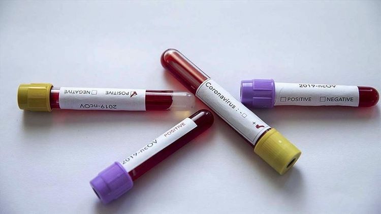 Africa's COVID-19 cases surpass 306,000