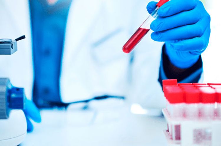 Coronavirus cases in Armenia reach 23247