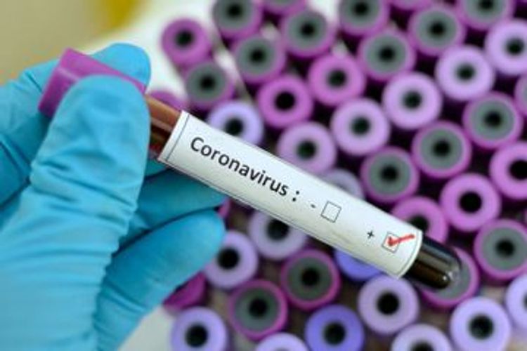 468967 coronavirus tests conducted in Azerbaijan so far