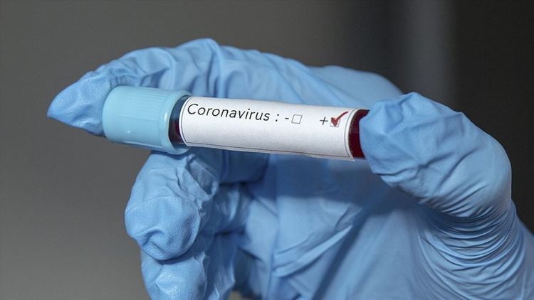 Infectiologist: "Viruses can be easily killed with disinfectant solutions"