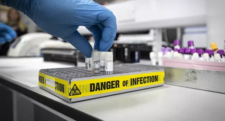 WHO: Coronavirus fatality rates higher than initially thought 