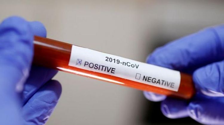 Costa Rica raises coronavirus cases to nine, including three Americans
