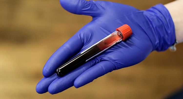 US to begin clinical trial of possible coronavirus vaccine on Monday amid ongoing pandemic 