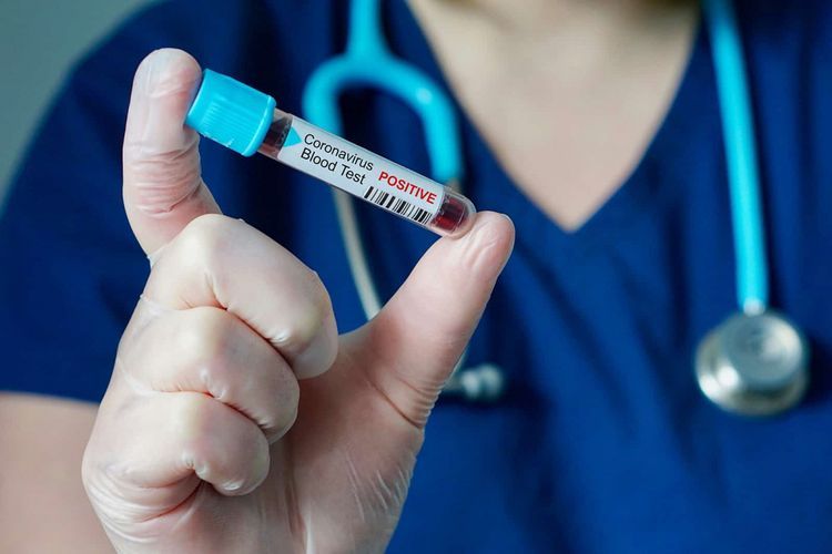 Azerbaijani Parliament to discuss fight against coronavirus tomorrow