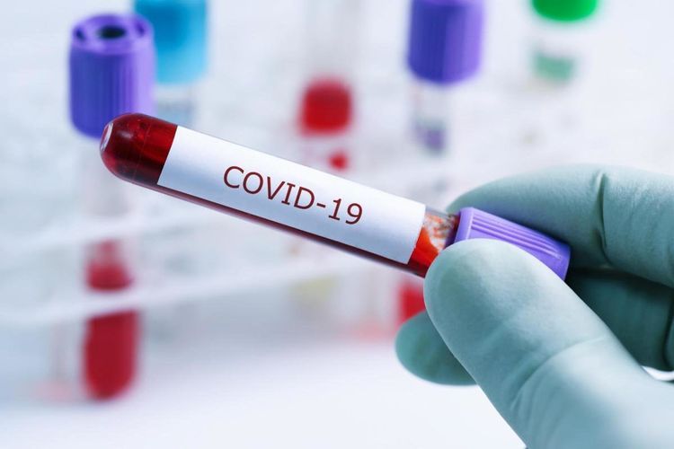 Head of Department of Virology: "As the temperature rises, the chances of the virus surviving become less"