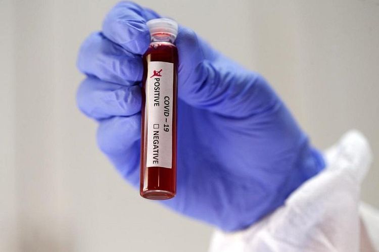 Kazakhstan confirms 7 new COVID-19 cases  
