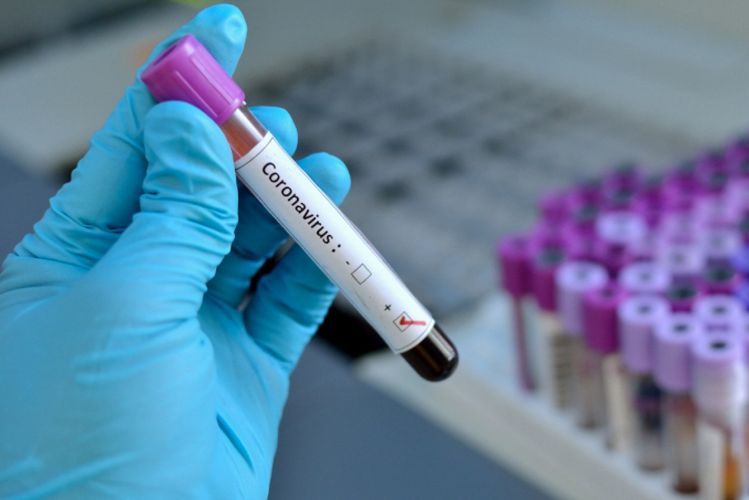 Became known through which sources the Fund to Support Fight Against Coronavirus to be formed