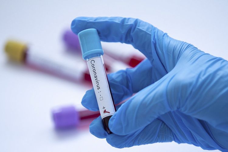 Mali reports first two cases of coronavirus