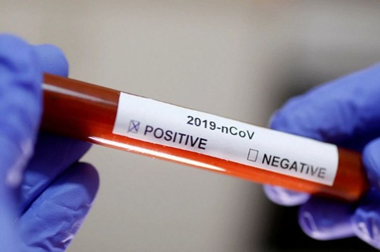Number of coronavirus cases in Armenia reaches 482