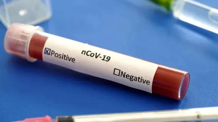Number of coronavirus cases increases to 108 in Georgia