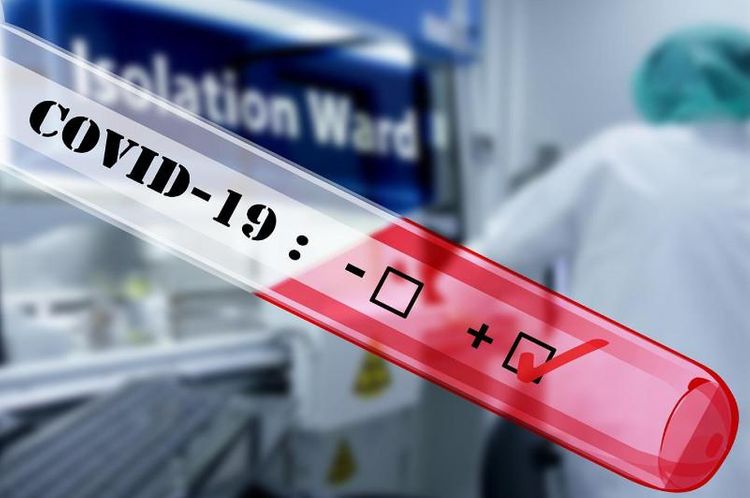 102 new coronavirus cases confirmed in Kazakhstan 