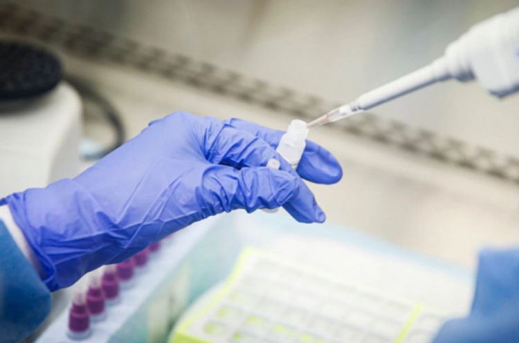 Armenia's COVID-19 cases reach 2,507,  growing by 121 in past day