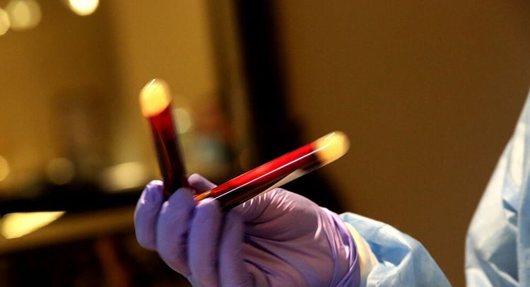 COVID-19 may damage protein that transports oxygen in blood 