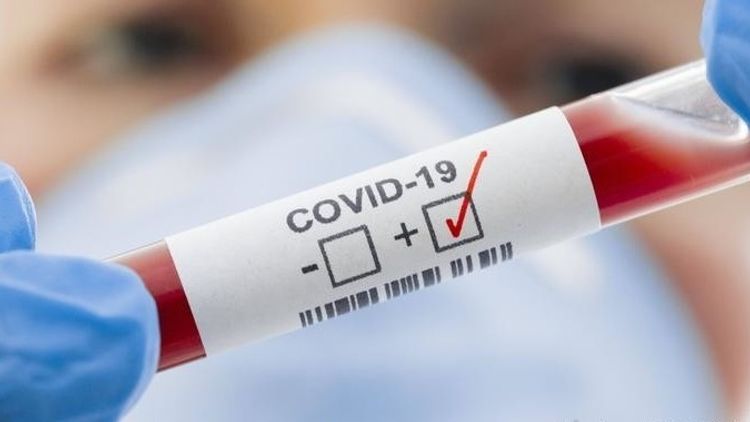Kyrgyzstan reports 11 new COVID-19 cases bringing country's total to 906