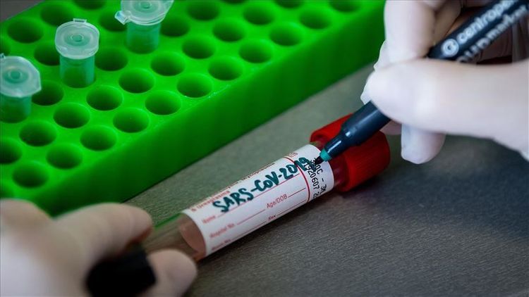 Coronavirus cases worldwide surpass 4.1 million