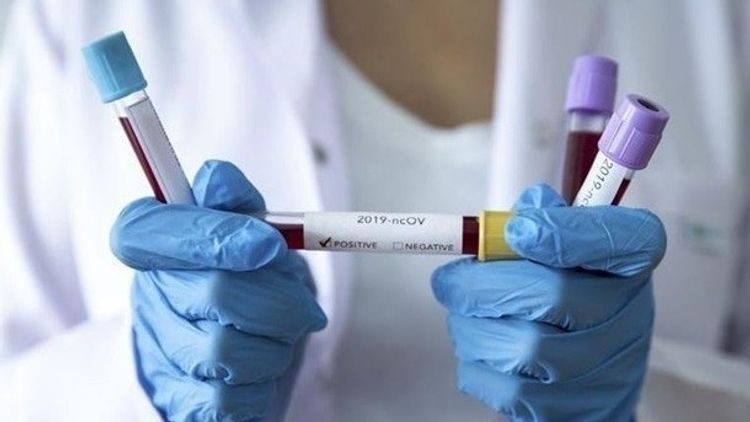 Kyrgyzstan confirms 29 new COVID-19 cases bringing country's total to 1,111