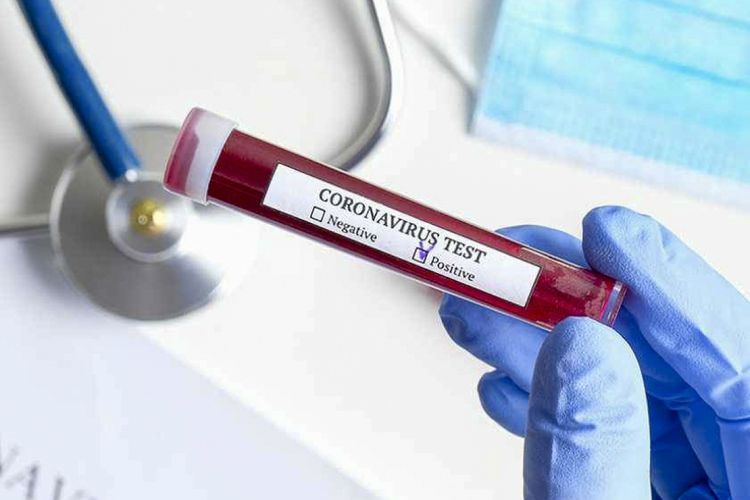 Number of people infected with coronavirus in Georgia surpasses 700