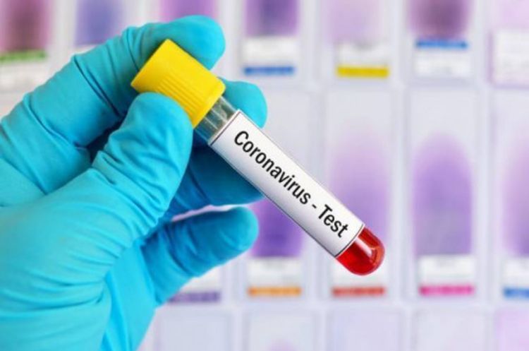Number of coronavirus cases in Armenia grows by 322 in past 24 hours, reaching 5,928