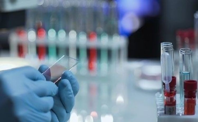 Uzbekistan reports 46 imported cases, 3,261 in total