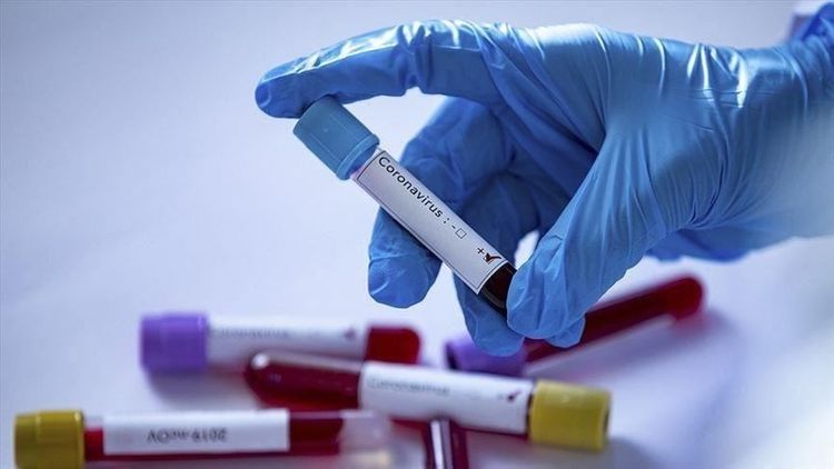 Kyrgyzstan confirms 74 new cases of coronavirus, 1,594 in total