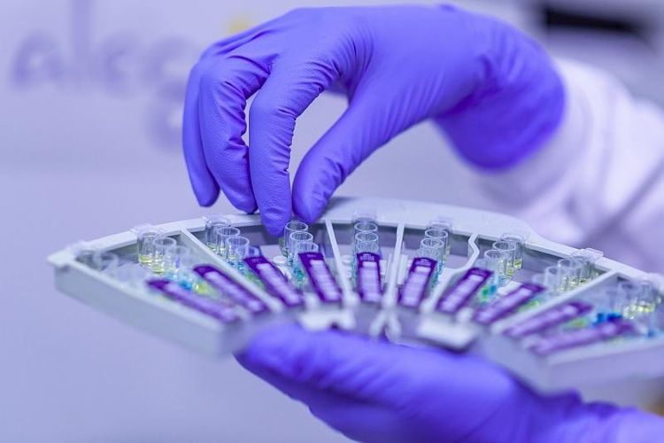 723 tested positive for coronavirus in Kazakhstan