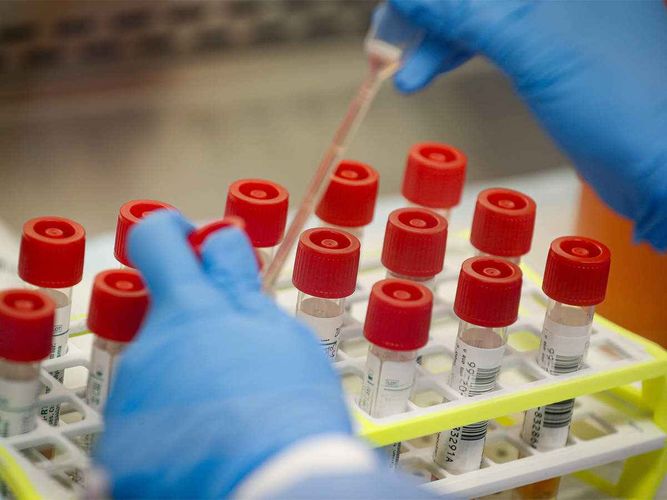 US Health Authority approves 1st self-testing kit for COVID-19