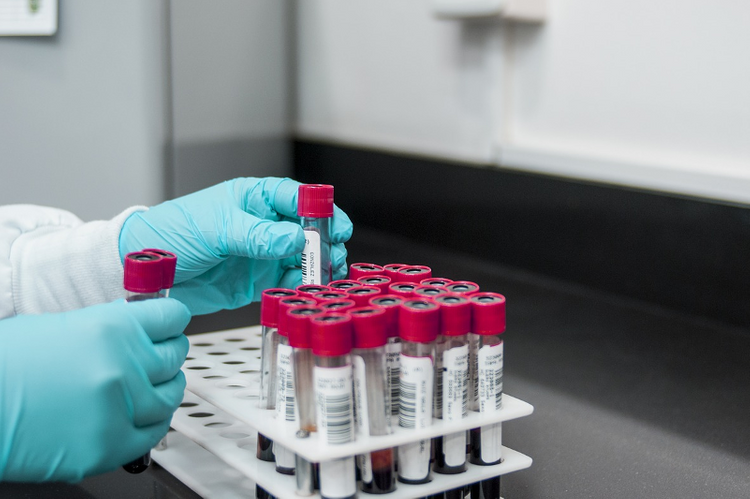 Kazakhstan adds over 800 new daily COVID-19 cases  