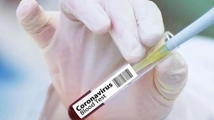 The Azerbaijan Wrestling Federation announced that its national members have been infected with the coronavirus