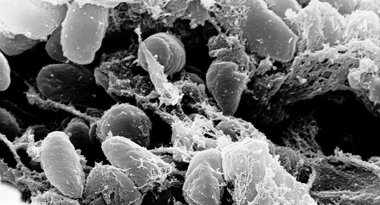 Mongolia confirms Bubonic plague case in western province, Zoonotic diseases centre says
