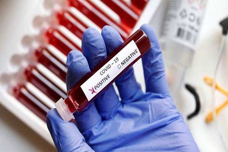 UK reports 2,659 new COVID-19 cases on Wednesday