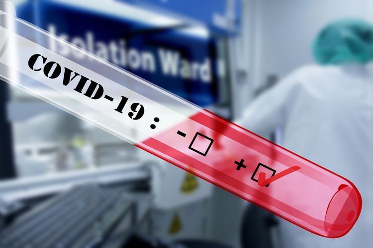 1,009,478 coronavirus tests conducted in Azerbaijan