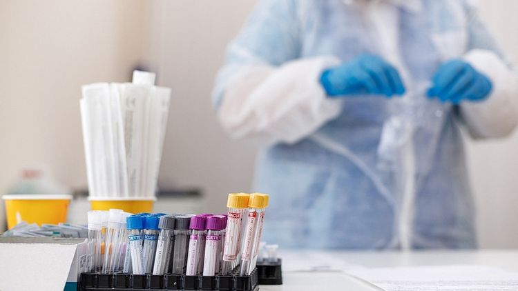 Kazakhstan reports 52 new COVID-19 and 77 pneumonia cases
