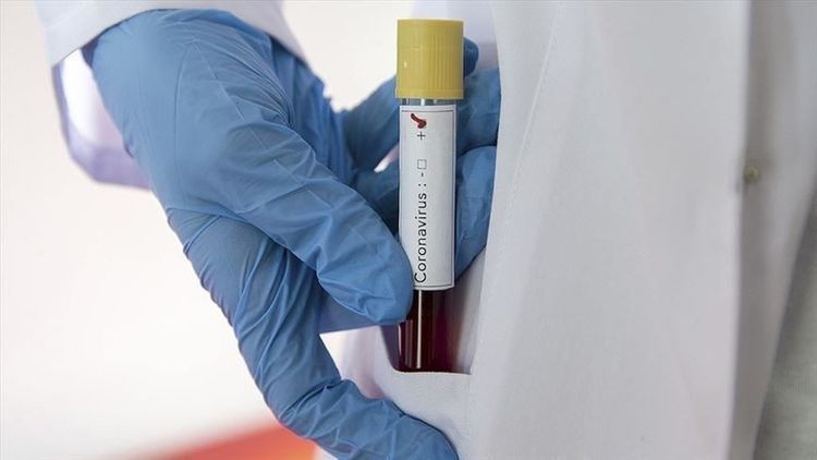 Number of confirmed coronavirus cases reaches 39,042 in Azerbaijan, 574 deaths