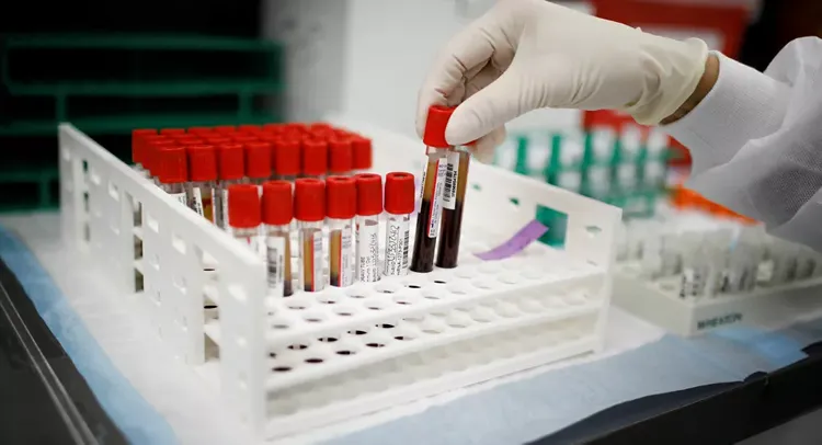 Russia's COVID-19 case total rises by 7,523 over past day to 1,143,571