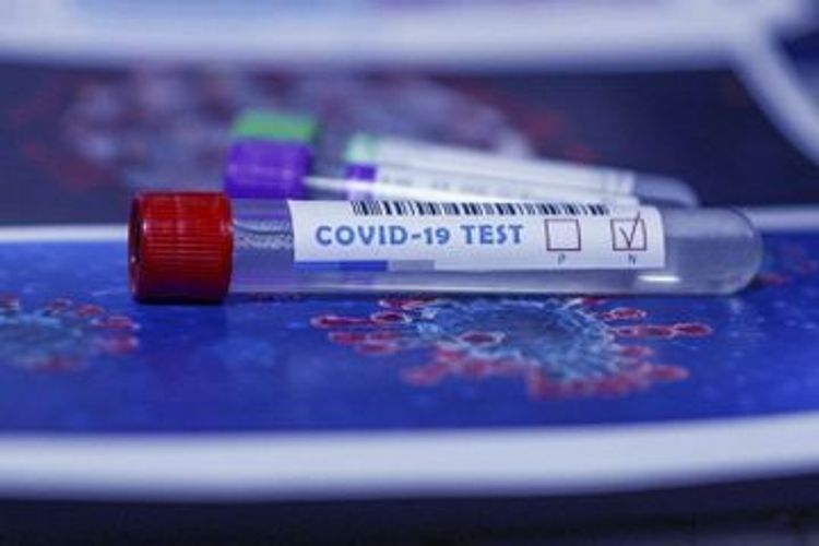 2 901 160 coronavirus tests conducted in Azerbaijan so far
