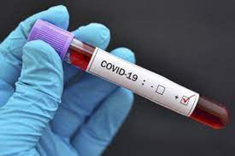 Number of confirmed coronavirus cases reaches 303858 in Azerbaijan, 4203 death cases
