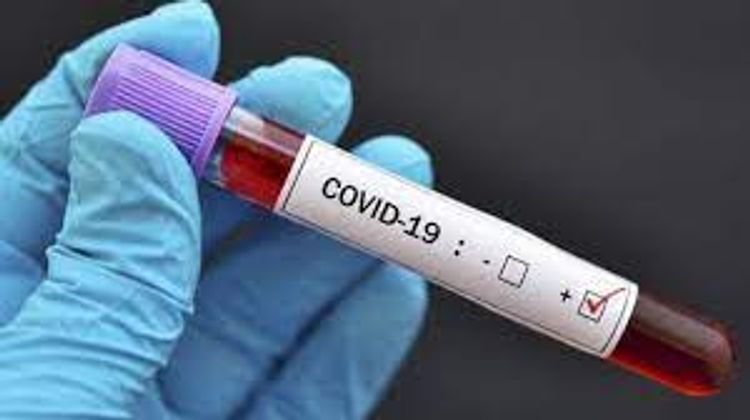 Number of confirmed coronavirus cases reaches 307 980 in Azerbaijan, 4274 death cases