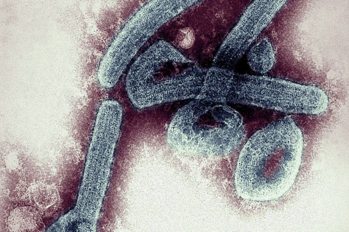 Ebola-like Marburg virus found in Guinea