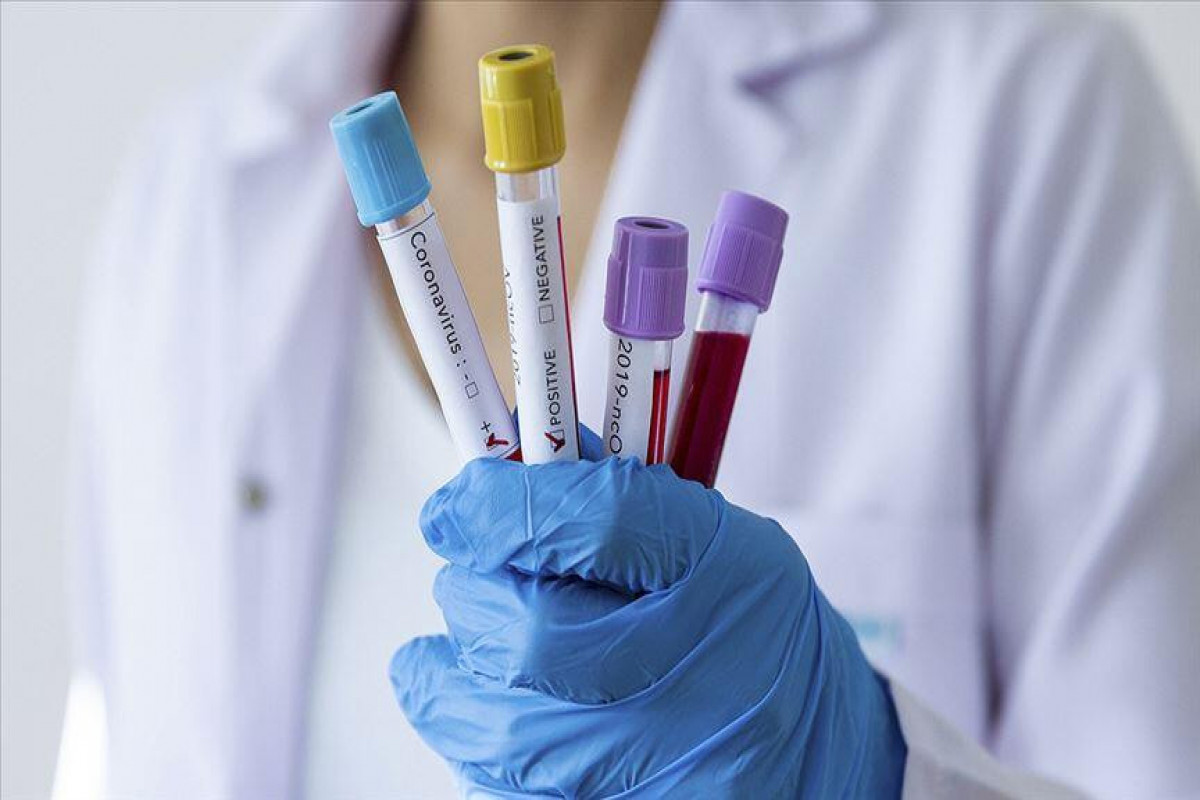 Turkey reports 19,191 COVID-19 cases, 230 deaths
