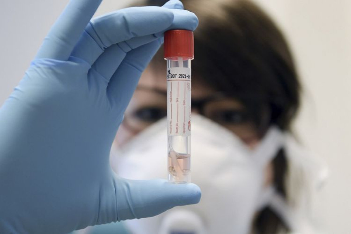 Germany reports 61,288 new daily coronavirus cases