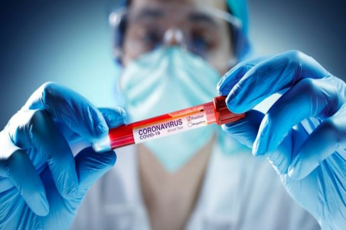 Iran records 67 coronavirus-related deaths over the past day