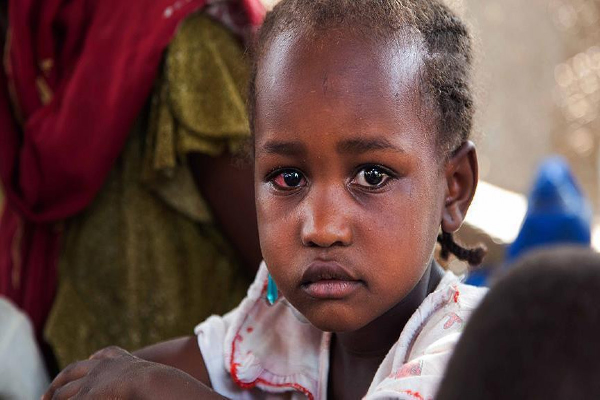 89 people are killed by mystery disease in South Sudan