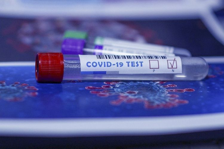 2412034 coronavirus tests conducted in Azerbaijan so far