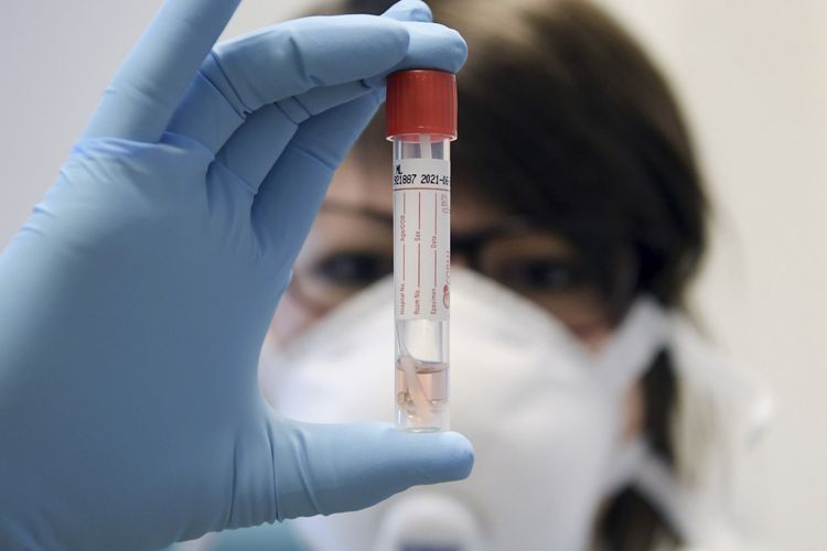 Russia's coronavirus death toll exceeds 81.000
