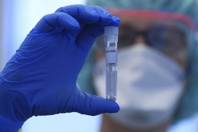 Armenia's coronavirus death toll reaches 3,159