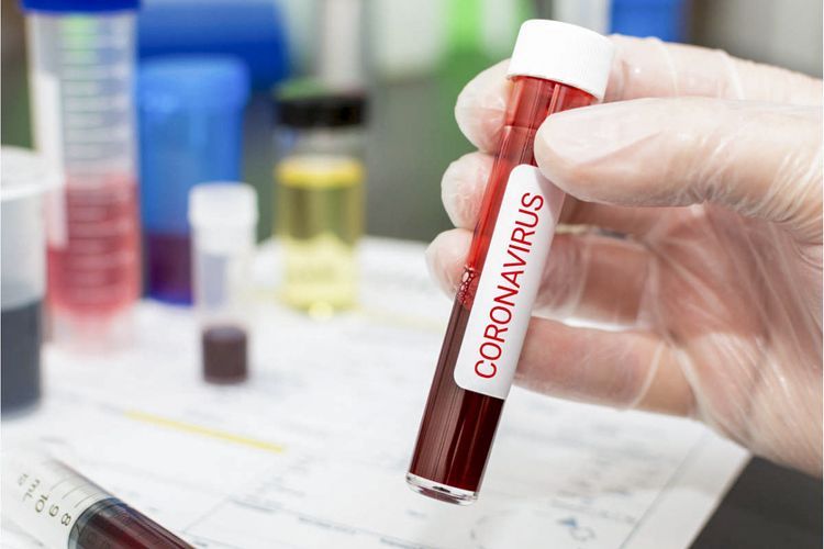 Russia confirms 22,857 new coronavirus cases