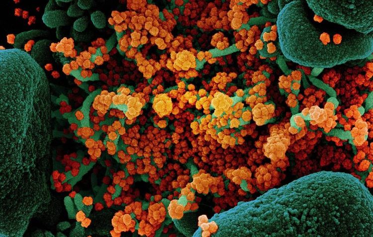 COVID-19 antibody testing should be done before vaccination, expert says