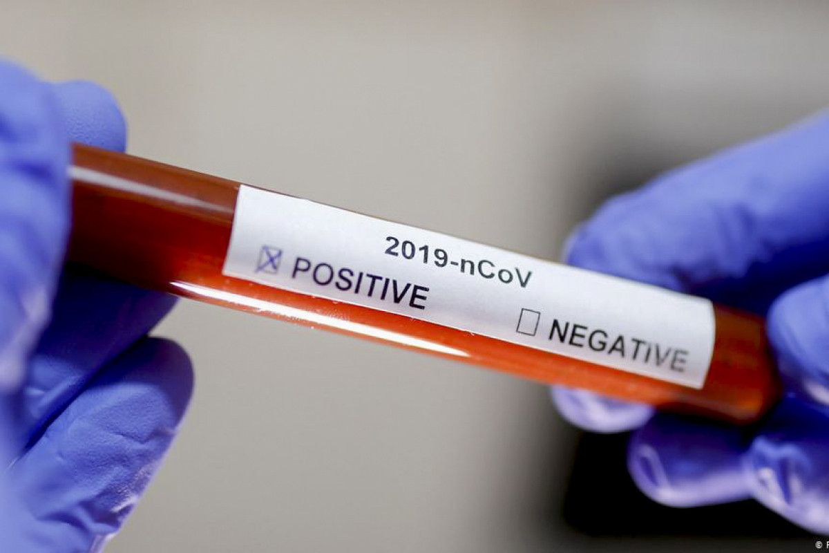 Georgia records 1 233 coronavirus cases over past day