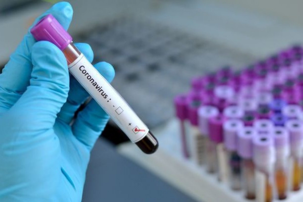 TABIB clarifies whether Indian strain of Covid-19 recorded in Azerbaijan or not 
