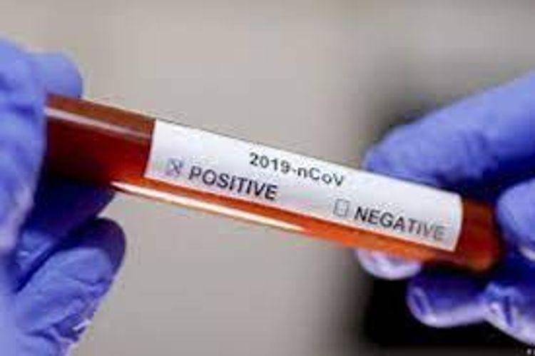  Number of confirmed coronavirus cases reaches 257 330 in Azerbaijan, 3,513 death cases